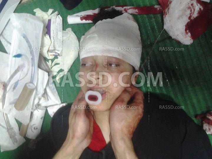 الإخوان للانقلابيين: أليس لكم أعين تبصرون بها؟