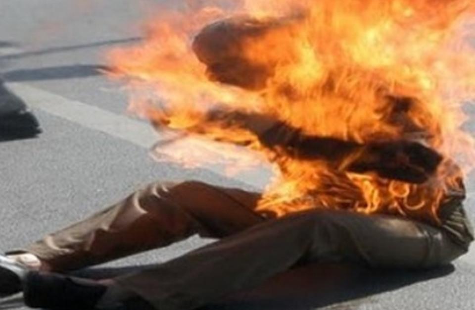 بعد رسوبه.. طالب بثانوية سوهاج  يشعل النار في نفسه