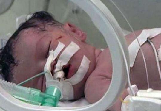 فيديو | الرضيعة “شيماء” تلحق بأمها إلى السماء