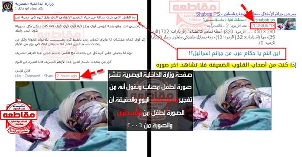 الداخلية تنشر صورة لطفل فلسطيني مصاب بدلا ممن بتر ساقه