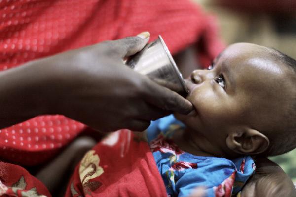 سوء التغذية يحاصر ربع سكان جنوب الصحراء بأفريقيا