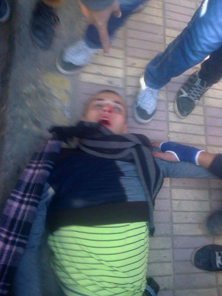 عاجل..استشهاد طالب بجامعة الازهر بخرطوش في الوجه